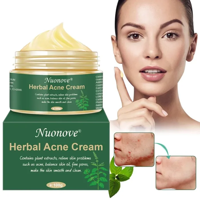 Acne Crema, Crema Anti Acne, Cicatrici Viso… In saldo
